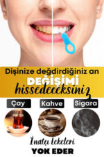 Diş  Silgisi 1 Aparatlı + 5 Yedek Süngerli Set 1 Paket - Görsel 3